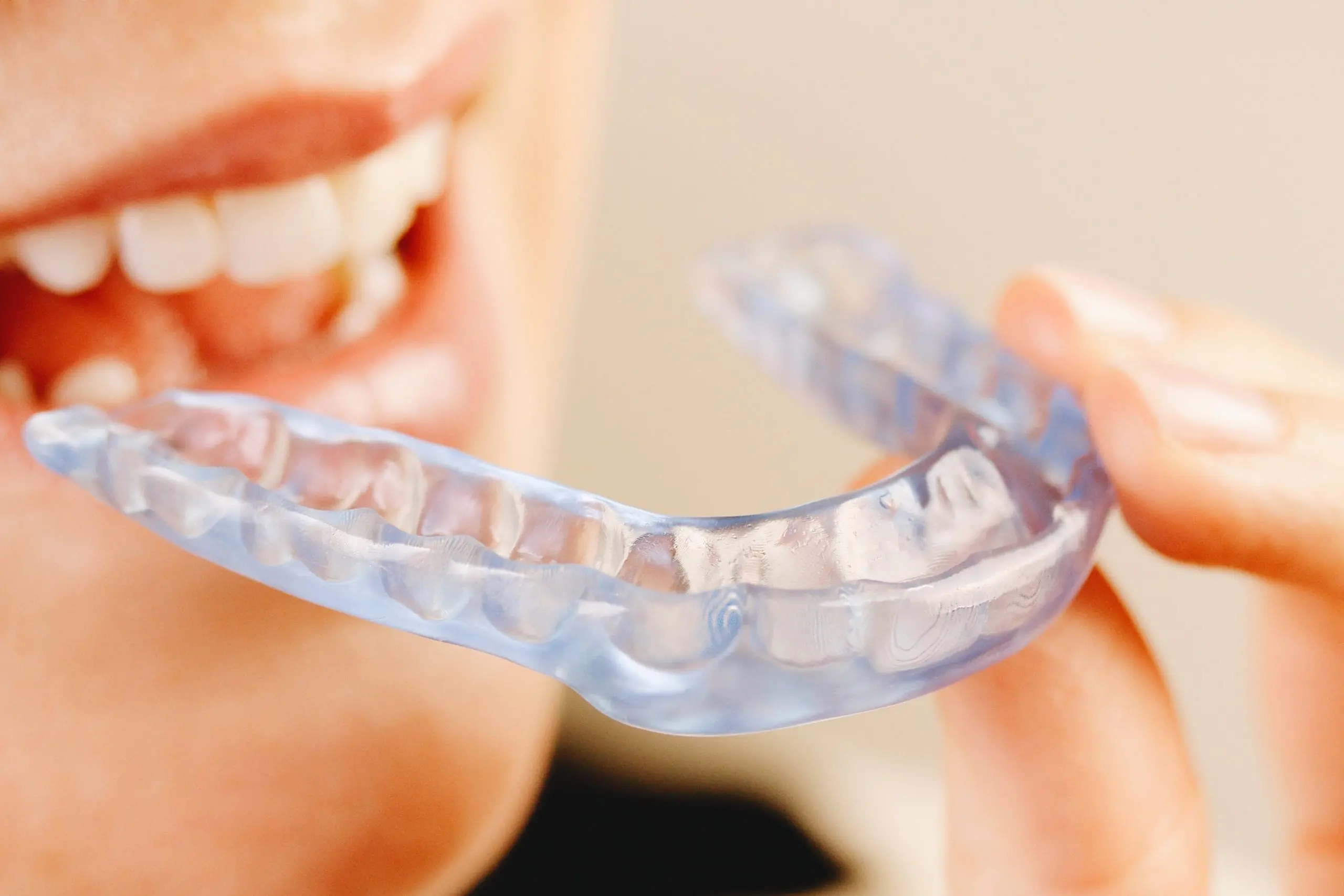 Bruxismo y dolor mandibular: cuándo pedir una férula de descarga