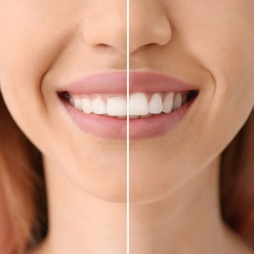 Periodoncia en Santa Cruz de Tenerife